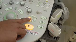 Toshiba Xario 200 Ultrasound Machine  Features Explanation with English Captions [upl. by Nyltac]