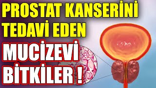 Prostat Kanseri Neden Olur Ve Tedavi Eden Mucize Bitki [upl. by Bilac]