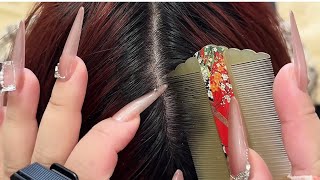 ASMR Satisfying Scalp Experience Hands and Comb Dandruff Removal [upl. by Naitirb]