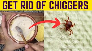 Effortlessly Remove Chiggers from Your Yard amp Prevent Their Bites [upl. by Tresa]