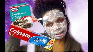 I APPLIED TOOTHPASTE VASELINE amp BAKING SODA ON MY FACE THIS IS WHAT HAPPENED AFTER [upl. by Jessabell]