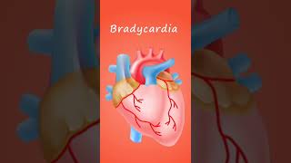 bradycardia biology science [upl. by Aneehsal754]