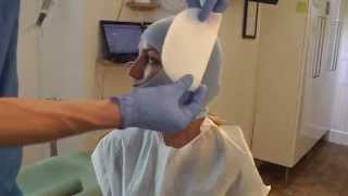 First Stagep1 of MewVector Orthodontic Orthotropics Headgear Head Brace Preparation Dr Mike Mew [upl. by Arolf]