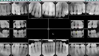 DEXIS™ Imaging Suite  Patient Screen Overview [upl. by Gent]