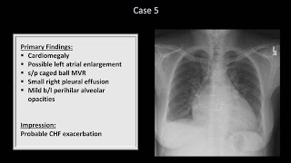 How to Interpret a Chest XRay Lesson 10  Self Assessment Part 1 [upl. by Krigsman933]