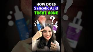 How does Salicylic acid treat acne acne salicylicacid serum csirnet neet biology sciencefact [upl. by Astto132]