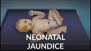 Neonatal Jaundice by L Veit  OPENPediatrics [upl. by Malva]