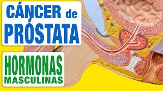 Cáncer de Próstata y Hormonas [upl. by Benni58]