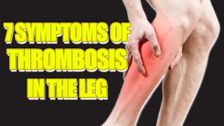 Top 7 Signs and Symptoms of Leg Blood Clots  Preventing Deep Vein Thrombosis [upl. by Adlecirg]