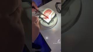 Neurosurgical endoscope medical endoscopicspinesurgery neurosurgeon students neurosurgical [upl. by Akihsal]