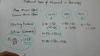 Different types of movement in Retinoscopy [upl. by Neehahs964]
