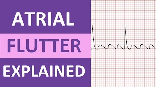 Atrial Flutter ECG Causes Treatment Nursing NCLEX ACLS Heart Rhythm Explained [upl. by Ahsienad411]