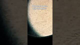 abnormal sperm with tail defect abnormal sperm tail defected viralvideo mlt medical [upl. by Crim]