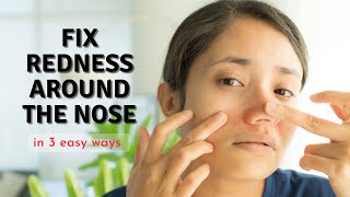 How to Fix Redness Around Nose in 3 Easy Ways [upl. by Ahsienor507]