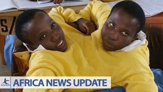 Africas Longest Living Conjoined Twins Maria and Consolata Die [upl. by Husein]