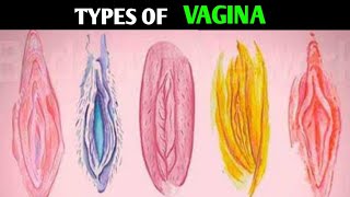 Types Of Vagina  Shapes and Size  Most Attractive Type [upl. by Sharp]