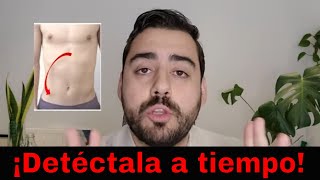 7 señales de que tu dolor de abdomen es apendicitis [upl. by Conni150]