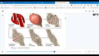 4447 CONCEPTS OF CARE FOR PTS WITH MUSKULOSKELETAL TRAUMA PART 1 [upl. by Naerad481]