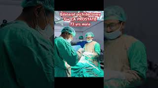 Bilateral orchidectomy  carcinoma prostate  dr bijay [upl. by Eilsel674]