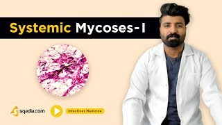 Systemic Mycoses I  Infectious Medicine  Clinical Video Lectures  Medical VLearning [upl. by Daughtry]