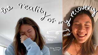 the reality of recovering from an ED my journey [upl. by Julis]