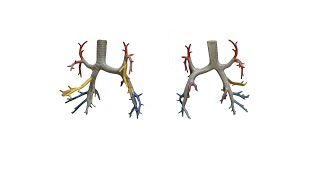 Tracheobronchial tree trachea  bronchi ENG [upl. by Ettenowtna]