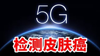 用5G信号低成本快速检测皮肤癌，什么原理？ [upl. by Winnick]