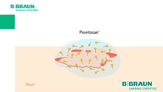 Prontosan®  Sehen Sie das Betain in Aktion [upl. by Babita]