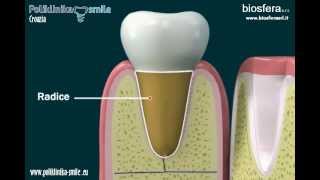 Anatomia dentale  Anatomija i građa zuba  Poliklinika Smile [upl. by Kaela474]