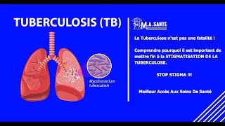 Tuberculose  Mythes brisés et faits surprenants [upl. by Galven963]