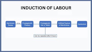 Induction of Labour Explained [upl. by Adaner]