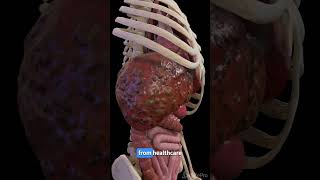 Understanding Liver Cirrhosis Key Facts anatomy meded 3dmodel [upl. by Adriane]