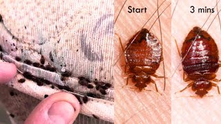 BED BUG BITES SYMPTOMS TREATMENT PREVENTION [upl. by Layton]