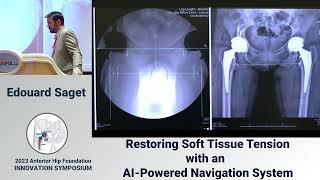 Advanced technology to achieve hip soft tissue balance Edouard Saget  AHF2023 [upl. by Gschu]