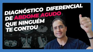 Desvendando o Enigma do Abdômen Agudo Inflamatório [upl. by Virginie]