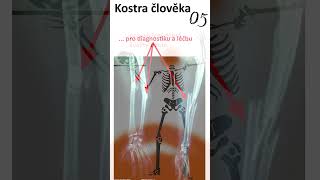 28 Kostra člověka05 anatomie biologie maturita [upl. by Eicyal753]