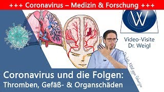 Wie Covid19 dem ganzen Körper schadet Lebensgefährliche Folgen durch Thrombosen amp Organversagen [upl. by Copp]