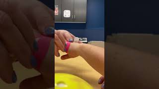 Metacarpal Fractures Kinesio Taping [upl. by Ossie566]