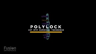 PolyLock MTP Surgical Technique [upl. by Phylis667]