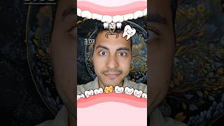 Rotten tooth extraction dentist game Derdo00 toothless dentist teeth rottenteeth game [upl. by Yrgoerg]