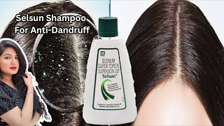 Selsun Shampoo  Selsun Shampoo For Dandruff  Best Treatment For Dandruff amp Hair Fall [upl. by Nnaitak]