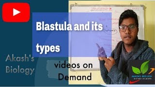 Blastula and its types [upl. by Keelby515]