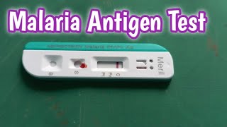 Malaria Antigen Test  How to Perform Malaria Antigen Test [upl. by Hgielyk]