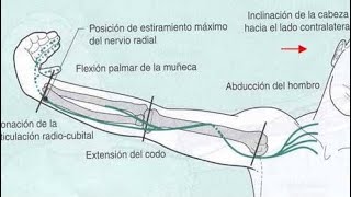 Ejercicio de Neurodinamia  Nervio Radial 🦴 [upl. by Attelrak]