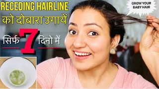 REGROW RECEDING HAIRLINE NATURALLY  Thinning Hairline को दोबारा उगाएं सिर्फ 7 दिनों में [upl. by Avruch]