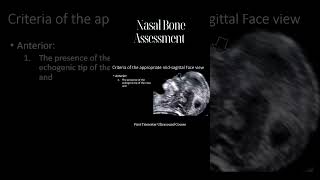 Perfect Midsagittal Fetal Face View in Ultrasound [upl. by Legin]