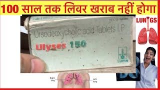 Ulyses 150mg Tablet Full Information In Hindi  Uses  Side effects  Dosage [upl. by Abocaj79]