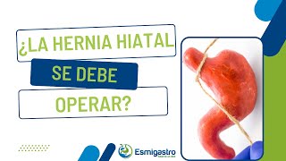 ¿La hernia hiatal se debe operar [upl. by Nayt552]