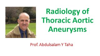 Radiology of Thoracic Aortic Aneurysms [upl. by Einnek]