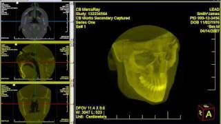 Rendering a 3D volume using LEADTOOLS Medical Workstation 3D Viewer [upl. by Atrebor796]